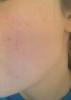 post-426560-0-30132800-1424206875_thumb.