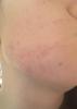 post-426560-0-93404600-1424206860_thumb.