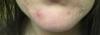 post-438795-0-16072800-1426206173_thumb.