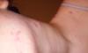 post-439006-0-48173000-1417769998_thumb.