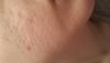 post-447829-0-34015000-1422336301_thumb.