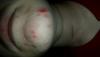 post-462861-0-04212800-1428734333_thumb.
