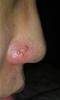 post-463086-0-76285500-1428863036_thumb.