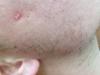 post-467677-0-16785000-1431110952_thumb.