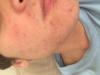post-469664-0-36354800-1432130471_thumb.