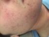 post-469664-0-80137900-1432130621_thumb.