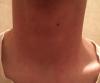 post-472442-0-12160000-1434755432_thumb.