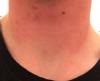post-472442-0-60805700-1434563685_thumb.