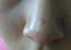 post-475981-0-30379300-1435385150_thumb.