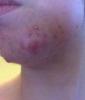 post-476182-0-08672700-1435607926_thumb.